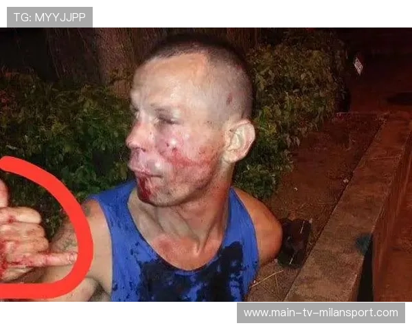 UFC 选手赛前称要“打死对手”，赛后被反杀